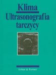 Ultrasonografia tarczycy