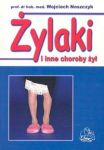 Żylaki i inne choroby żył