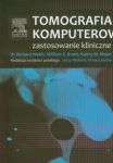 Tomografia komputerowa