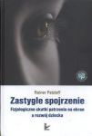 Zastygłe spojrzenie