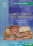 Implantologia stomatologiczna