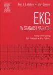 EKG w stanach nagłych