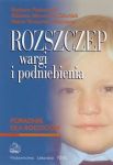 Rozszczep wargi i podniebienia